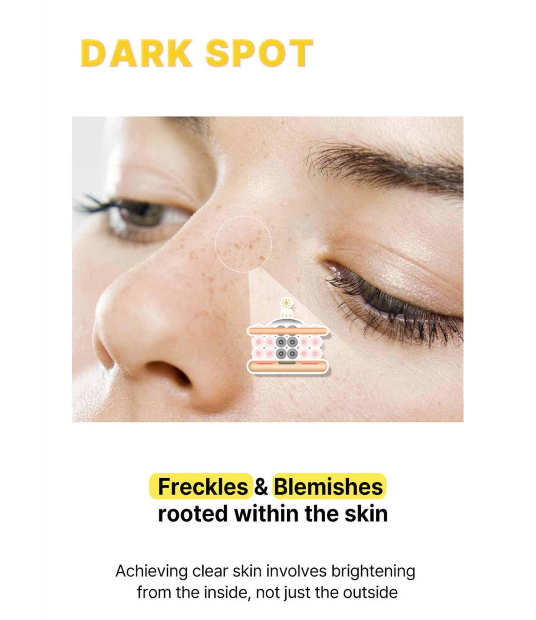 ACROPASS DARK SPOT CARE MICROCONE PATCH | 미백 관리 패치(6P)