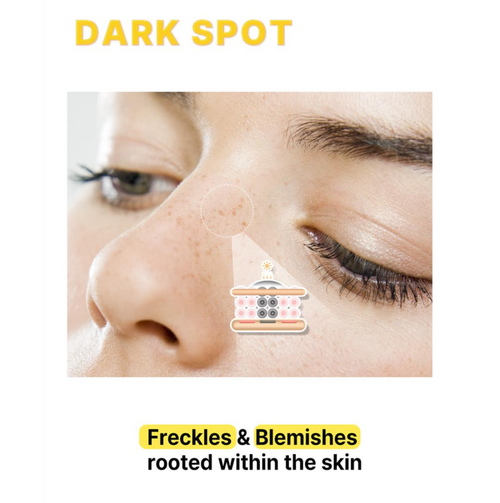 ACROPASS DARK SPOT CARE MICROCONE PATCH | 미백 관리 패치(6P)