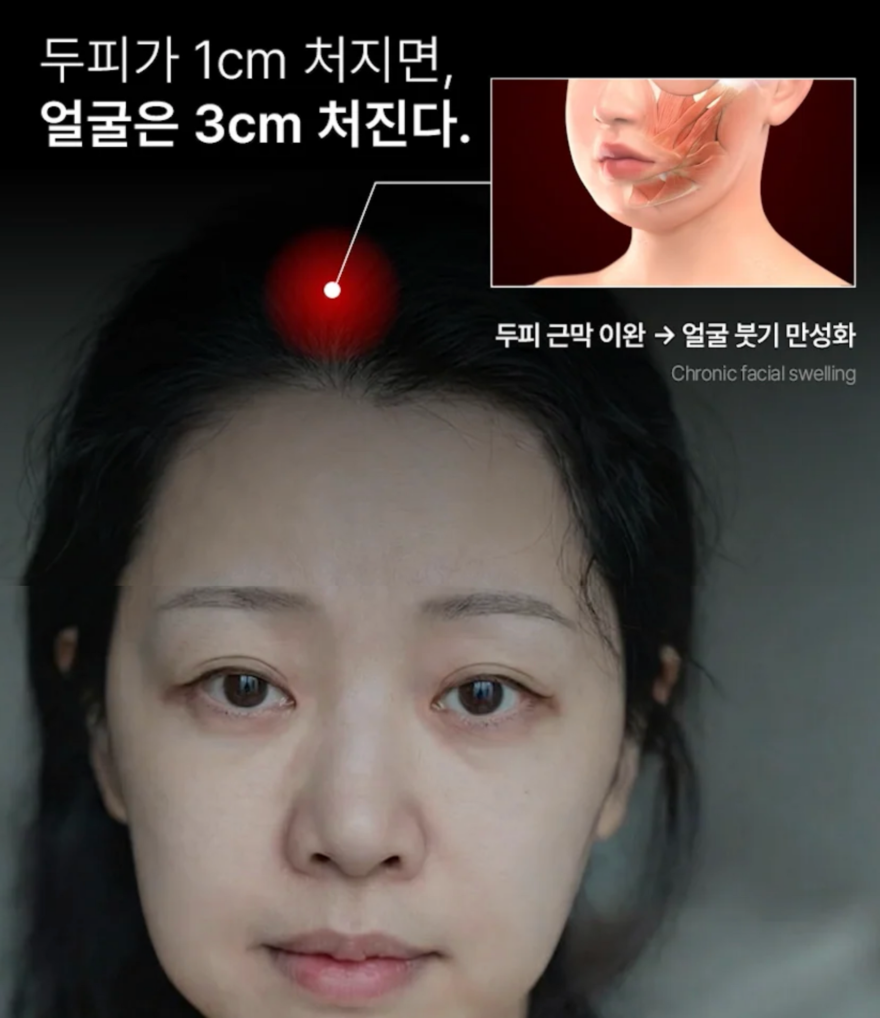 BEAUND HEAD SPA | 탈모 방지 및 얼굴 처짐 개선