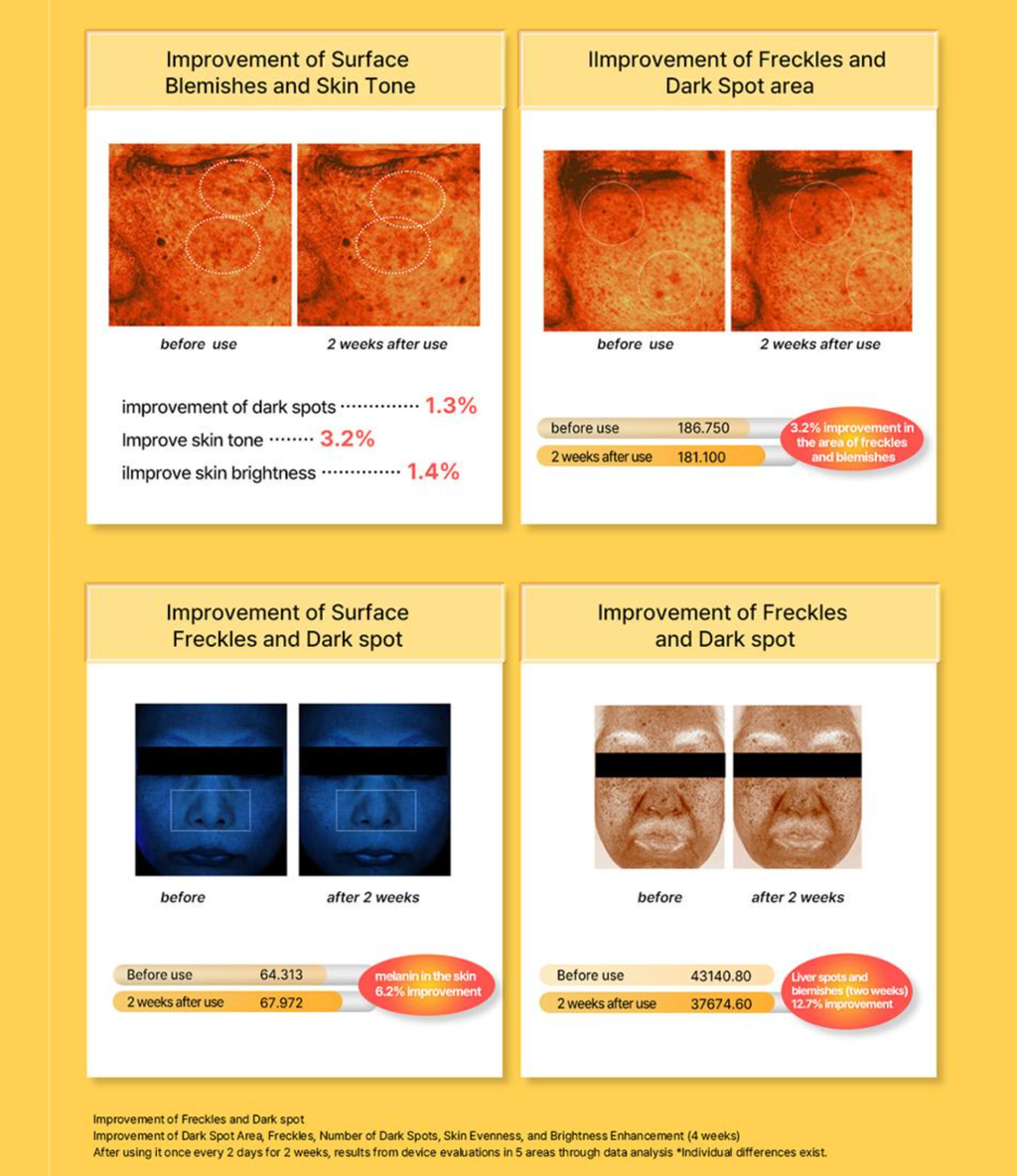 ACROPASS DARK SPOT CARE MICROCONE PATCH | 미백 관리 패치(6P)
