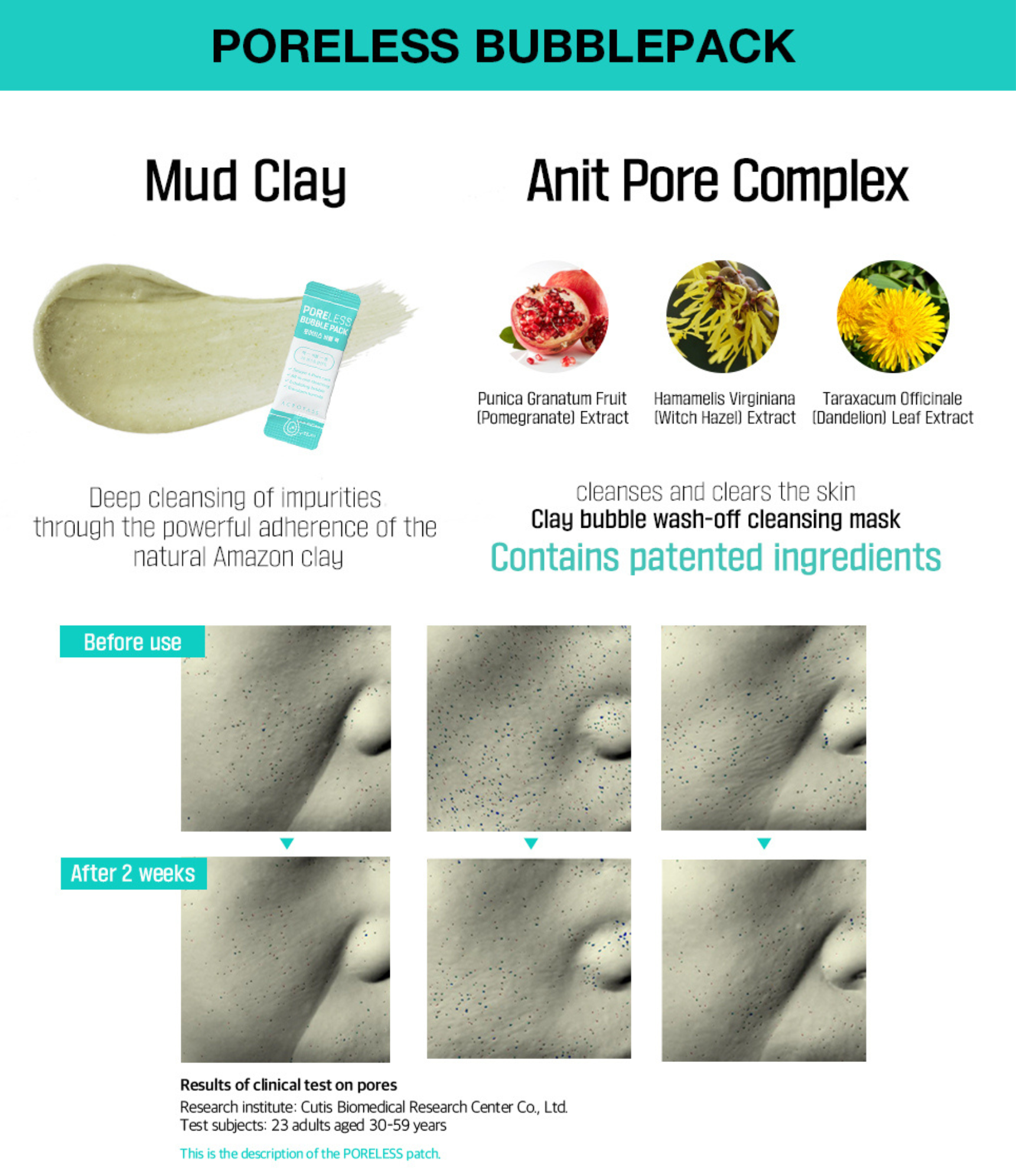 ACROPASS PORELESS MICROCONE PATCH | 모공 관리 패치(4P)