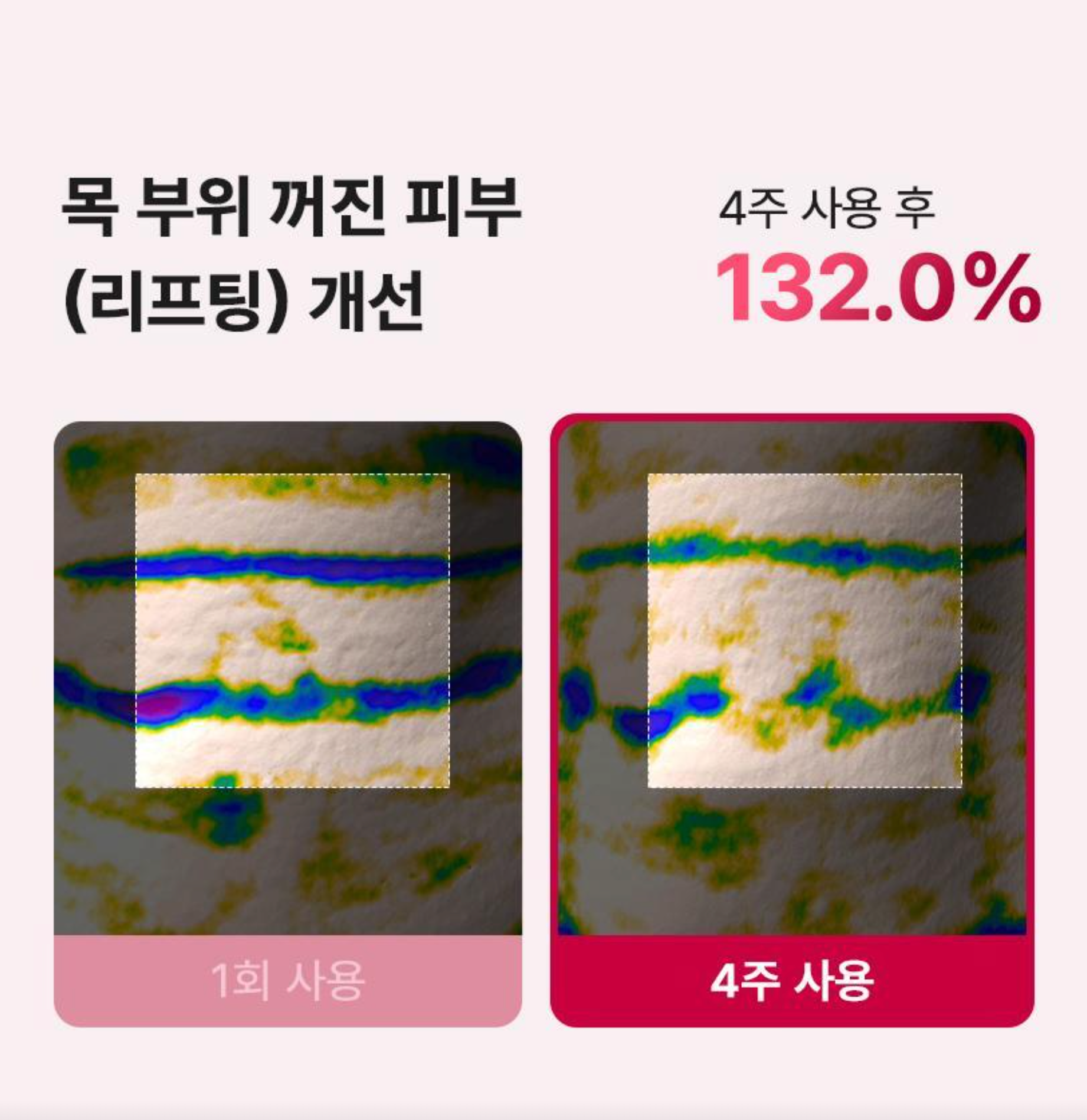 BEAUND NECK SILKY  | 뷰앤디 넥실키 5매입
