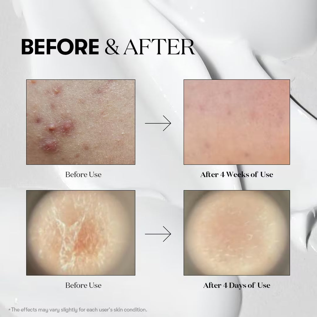 VT Cosmetics Cica Reedle Shot 100