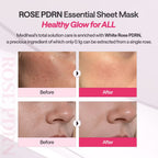 MEDIHEAL BEST KOREAN ROSE PDRN ESSENTIAL FACE MASK